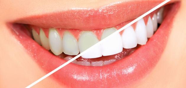 طرق طبيعية لتبييض الأسنان إبرازها استخدام الفراولة والليمون