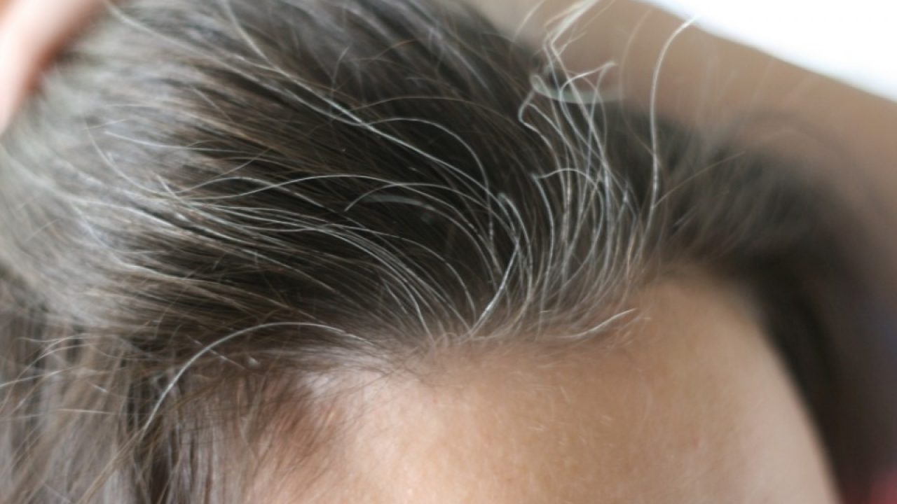 منها جوز الهند والحرنكش وصفا طبيعية لمقاومة ظهور الشعر الأبيض