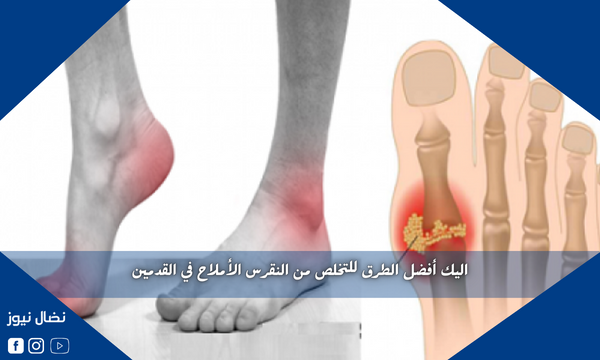 اليك أفضل الطرق للتخلص من النقرس الأملاح في القدمين