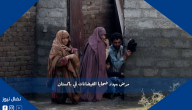 مرض يهدد ضحايا الفيضانات في باكستان