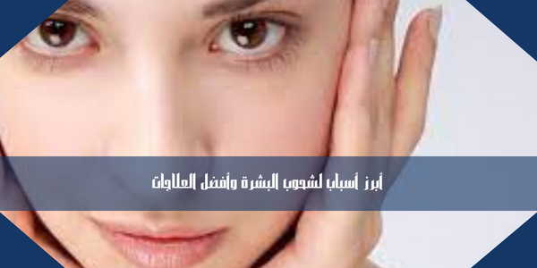 أبرز أسباب لشحوب البشرة وأفضل العلاجات